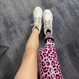 Woman wears leopard print wrap in pink on lower limb prosthetic